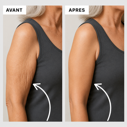 Calmira - Manchon Minceur & Raffermissant Bras